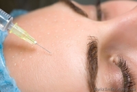 Инъекционная мезотерапия. - <ro>Изображение</ro><ru>Изображение</ru> #2, <ru>Объявление</ru> #1215188